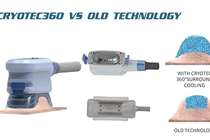 Cryotec VS old